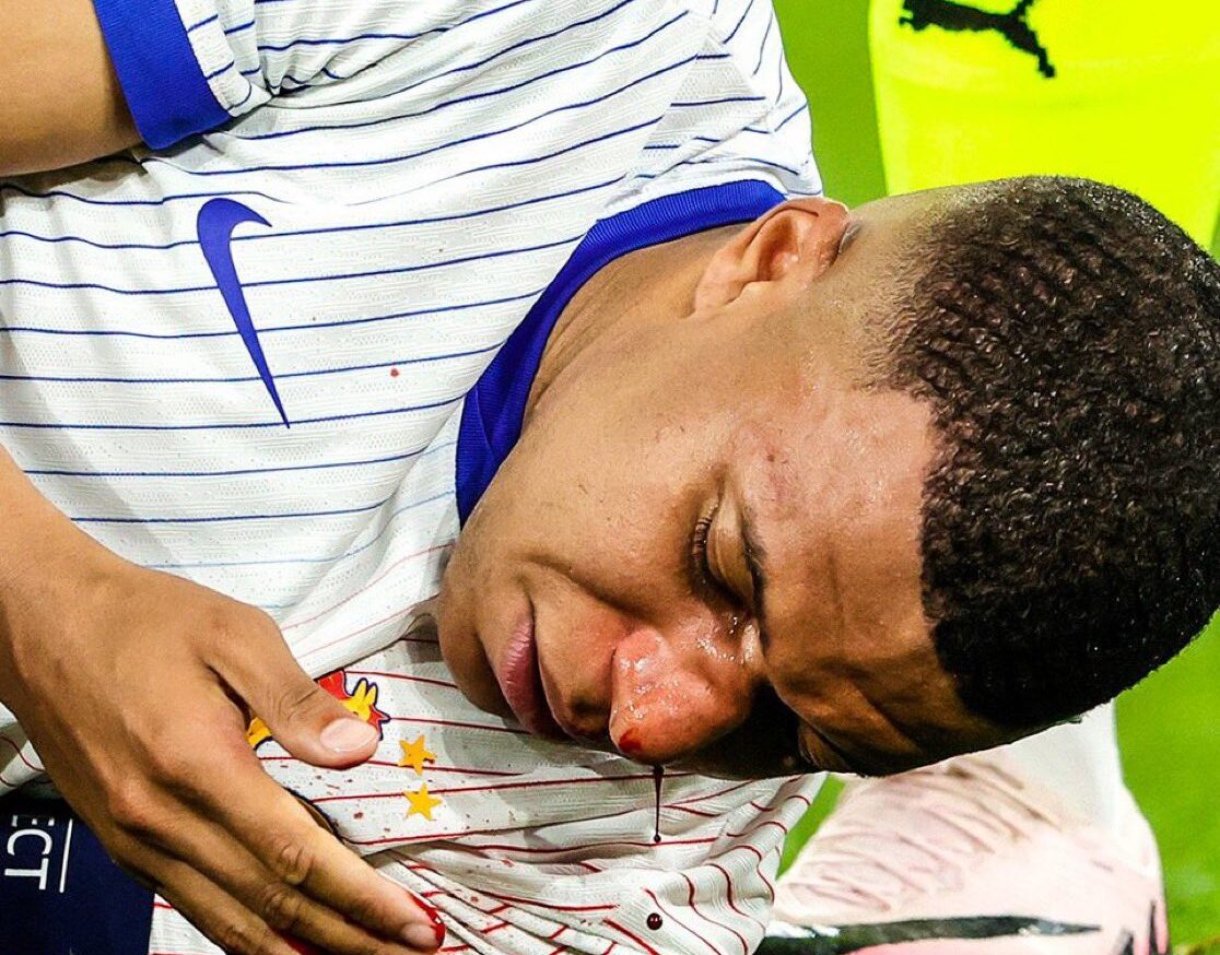 kylian Mbappe francia